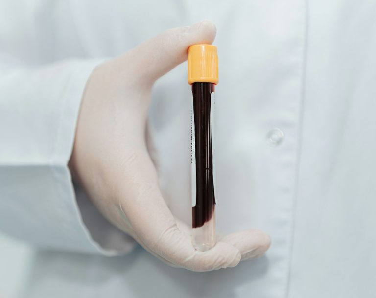 Leistung Blutanalyse