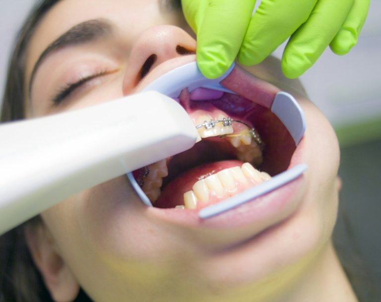 Leistung Punkt 3D-Scan